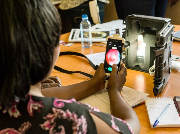 Interview: MobileODT using AWS cloud to save lives